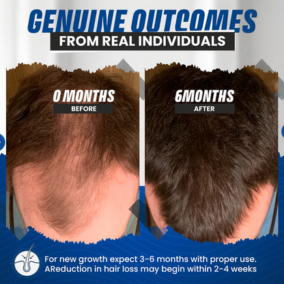 Anti-DHT Peptide Shield & Regrowth Serum