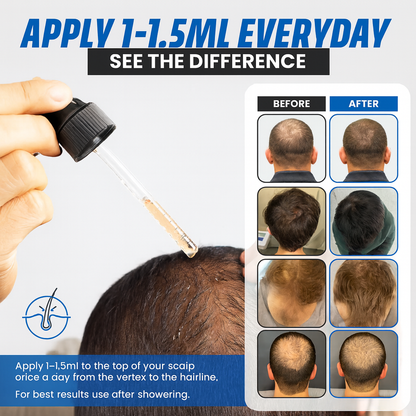 Anti-DHT Peptide Shield & Regrowth Serum